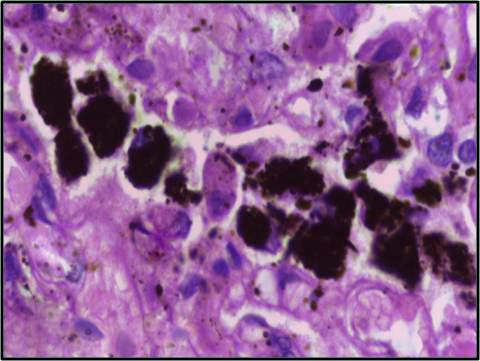 mukozilliäre Clearance (2-10 µm, ~20 mm/min) Clara Zellen (Keulenzellen): SP-A, SP-D Mastzellen: bei der Wache alveoläre Makrophagen (< 2 µm) Biologie der Atemwege 2.