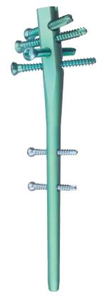 Abbildung 17 TriGen-PHN Die Implantation des TriGen-PHN wird ähnlich durchgeführt wie die Implantation der anderen beschriebenen Nägel. Über einen Deltoid-Split-Zugang, bzw.