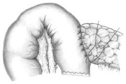 258 Bauchhöhle: Pankreas 65.