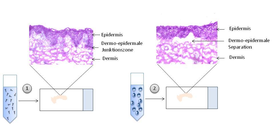 Die Effekte einer Inhibition der Januskinase 2 in in vitro Modellen der  Epidermolysis bullosa acquisita - PDF Free Download