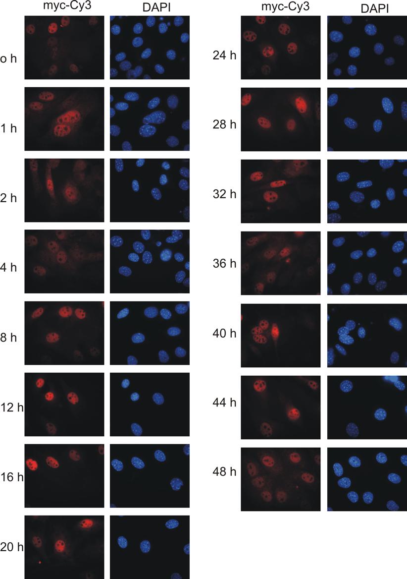 3 Ergebnisse 98 Abb.3.30 Die Proteinexpression von stabil transfiziertem mper1mutnes1,2 ist in synchronisierten Maus Fibroblasten nicht rhythmisch.