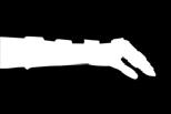 Morbus Dupuytren, Mittelhandfrakturen Karpaltunnelsyndrom (schweren Grades Nachtlagerung) Tendovaginitis (schweren Grades) Distorsionen / Kontusionen Bandverletzungen im Finger- / Handbereich A 21 cm
