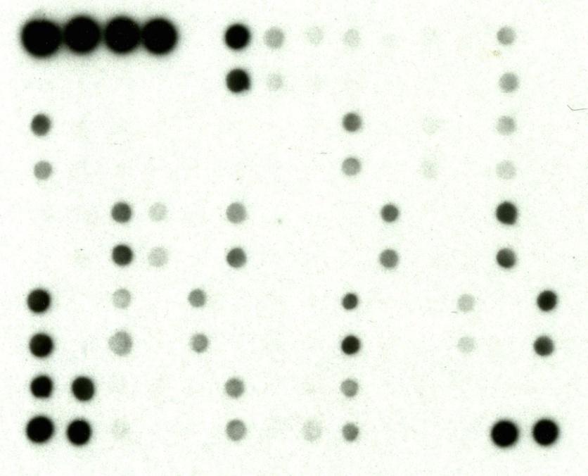 BMP-4- IGFBP-4+ IGFBP-2+ IFN gamma + IL-10+ IL-13+ IL-15+ IL-1