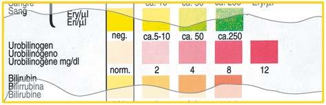Bewertung: Der Nachweis erfasst Werte ab 0,05 bis 0,1 mg Nitrit/dL Harn. Jede Rosafärbung zeigt einen behandlungsbedürftigen Nieren- oder Harnwegsinfekt an.