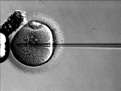 Spermiogrammparameter für eine Indikation zur Intracytoplasmatischen Spermieninjektion (ICSI) statt In-Vitro- Fertilisation (IVF) Eva Blozik, Hans-Hermann Dubben, Martin Scherer, Dagmar Lühmann