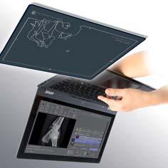 Die über einen Touchscreen einfach zu bedienende dicompacs DX-R Akquisitionssoftware passt sich Ihrem Arbeitsablauf an und