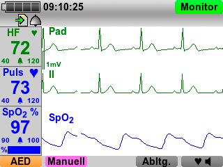 Features und Optionen Patientenüberwachung im Monitor-Modus Großes Farbdisplay 6-Kanal-EKG-Messung mit bis zu zwei EKG-Kurven SpO 2 -Messung und Anzeige von Pulsfrequenz