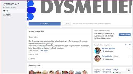 In Facebook gründete Ilse Martin 2011 die geschlossene Gruppe Dysmelien e. V., damit sich Menschen mit Dysmelie über unsere Landesgrenzen hinaus austauschen können.