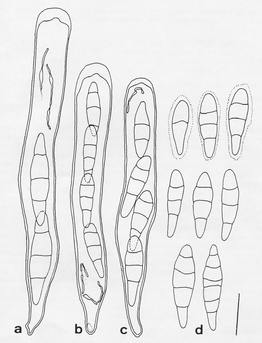 Cryptogamie, Bryol.Lichénol. 1995, 16(3): 177-190 183 Fig. 2: Cercidospora soror (Typus): a) Ascus mit nur 2 Ascosporen, 2 fehlgeschlagene Sporen noch zu erkennen.