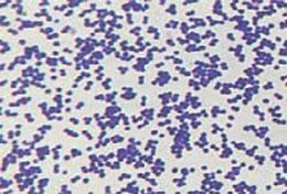 4 Kapitel 1 Grundlagen 1. Abb. 1.2 Kokkenflora in der Methylenblaufärbung ( 400). Abb. 1.3 Dichte Kokkenbesiedlung eines mit Methylenblau gefärbten Abstrichpräparates ( 200) Die DNA der Bakterien liegt»nackt«im Zytoplasma der Zelle vor.