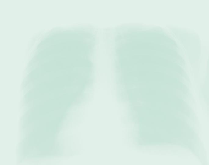 44ERKRANKUNGEN Lungen- und Atemwegserkrankungen Ausgewählte Erkrankungen Entzündliche Erkrankungen (z. B.