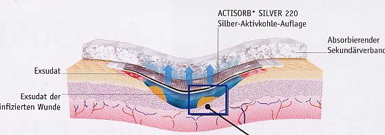 Durch ein spezielles Verfahren wird bei Actisorb 3 ( 220 ) elementares Silber an der Oberfläche der Kohlefasern imprägniert. Das Silber bleibt an der Kohlefaser.