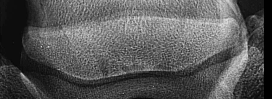 Das Strahlbein erscheint verwaschen, die Kontur ist nicht klar abgegrenzt. Die kleinwabige Struktur ist gut, die Canales sesamoidales sind nur schemenhaft zu erkennen. Canales sesamoidales Abb.