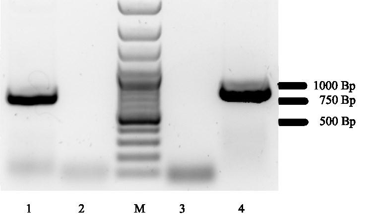 Ergebnisse 69 Abbildung 21: 1,5 %iges Agarosegel nach erfolgter PCR. Als Größenstandard wurde der GeneRuler 100 bp Plus DNA Ladder von Fermentas verwendet.