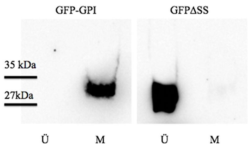 Ergebnisse 78 Um zu zelluläre Lokalisation beider GFP-Konstrukte zu überprüfen, wurden nach der Expression Zelllysate einer differentiellen Zentrifugation unterzogen um jeweils die Membranfaktion (M)