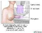 UNTERSUCHUNG Mammographie -