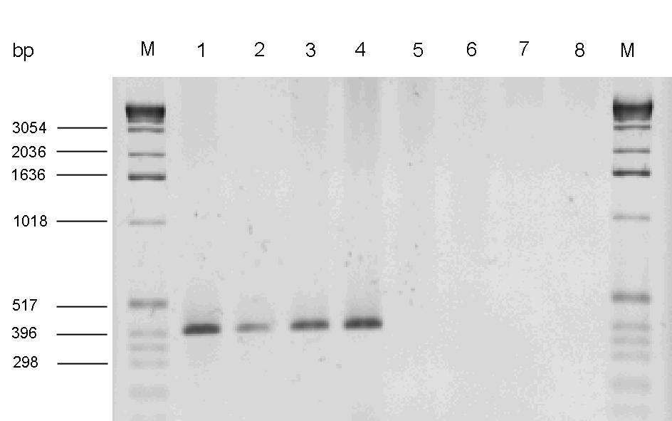 3.1.4 Nachweis des iron-gens Mit Hilfe des Primerpaares IroN 3.1/IroN 3.2 (Tabelle 2) konnte durch PCR- Analyse in drei der untersuchten 147 Stämme iron detektiert werden.