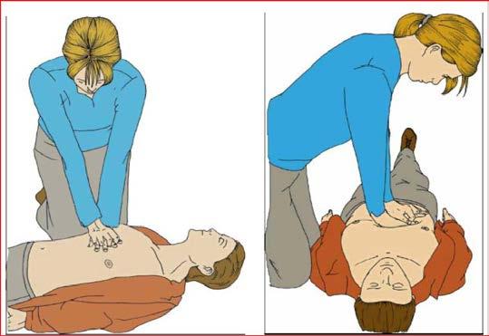möglichst nach 2 min CPR zur Vermeidung von insuffizienter Kompression durch