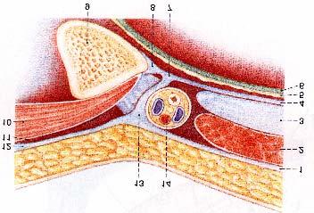 mit vergleichsweise steilem Verlauf des Leistenkanals. In dieser Stellung ist der innere Leistenring weiter geöffnet, als bei Anspannen der Bauchdecken, was zur Entstehung einer Hernie beiträgt.