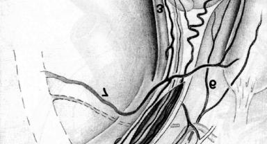 Aufgrund der Anatomie der Hodengefäßversorgung mit zahlreichen, den Hoden versorgenden Gefäßen und ihren Anastomosen, 1 : A.