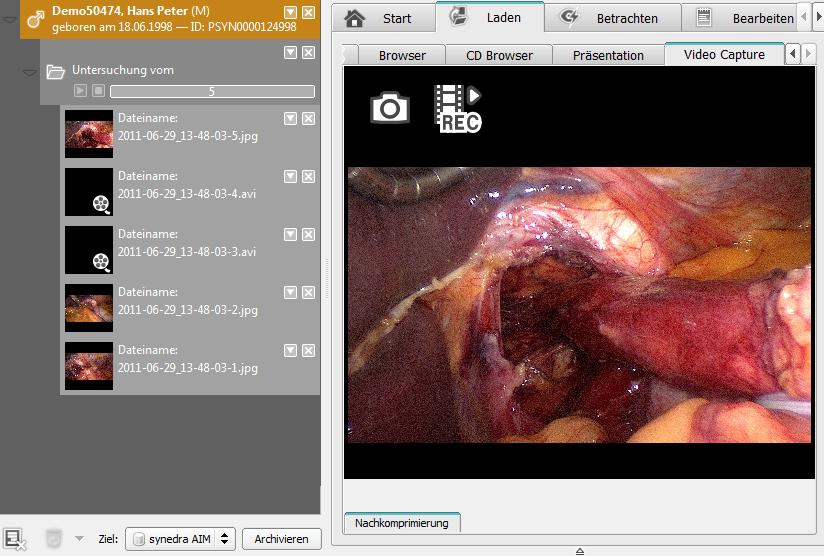 7. Endoskopie Starten Sie synedra View. Sie werden automatisch angemeldet. Im Reiter Laden > Video Capture sehen Sie das Live-Videosignal des Endoskops.