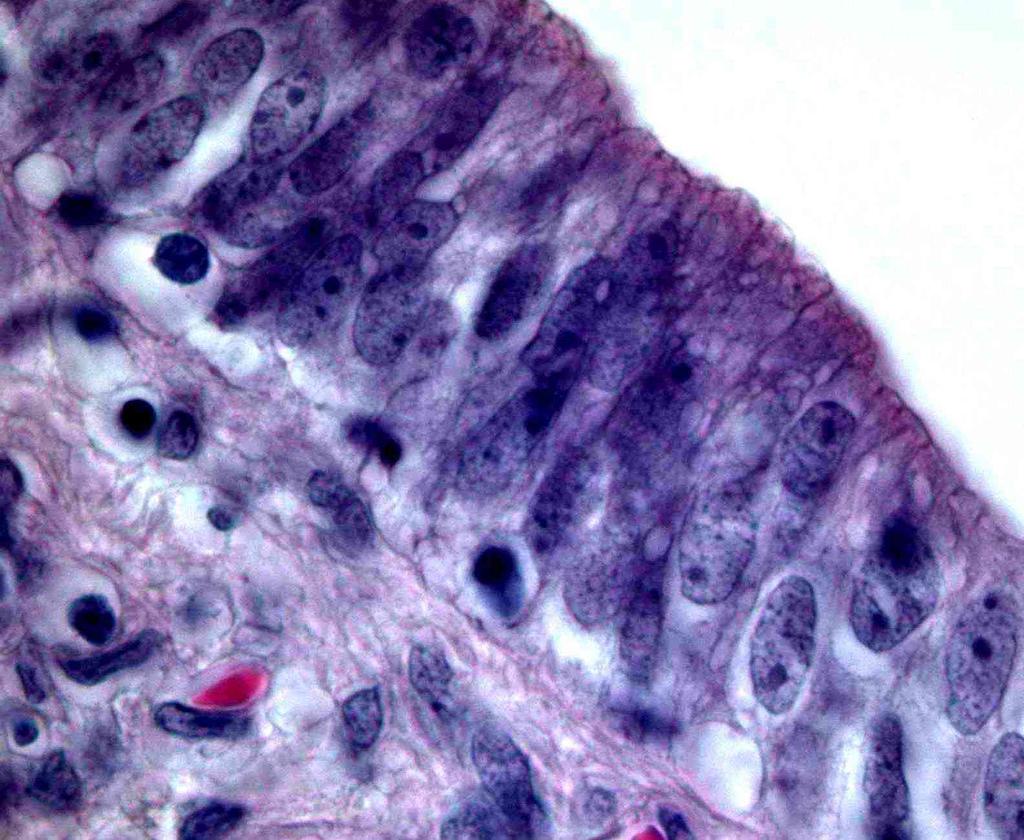 Die mikroskopische Betrachtung zeigt somit am 15. Tag ein regeneriertes, mehrreihig hochprismatisches Epithelium pseudostratificatum columnare (Abb. 33), welches jederzeit proliferieren kann.