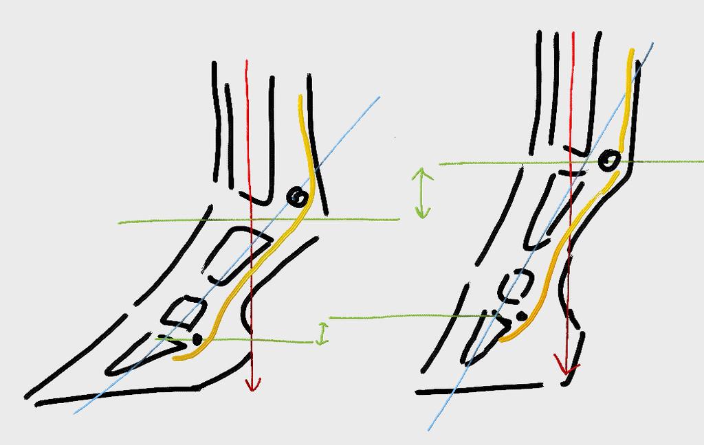 Folgen unterschiedlicher Winkelungen: Ein flacherer Hufwinkel hat zur Folge, daß die tiefe Beugesehne (gelb) einen längeren Weg um das Strahlbein herum bis zu ihrem Ansatz am Hufbein hat.