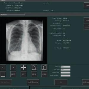 an das RIS zurück. Der Anwender erhält dank der MUSICA-Bildverarbeitung unmittelbar nach der Bildakquisition eine ausgewogen prozessierte Röntgenaufnahme.