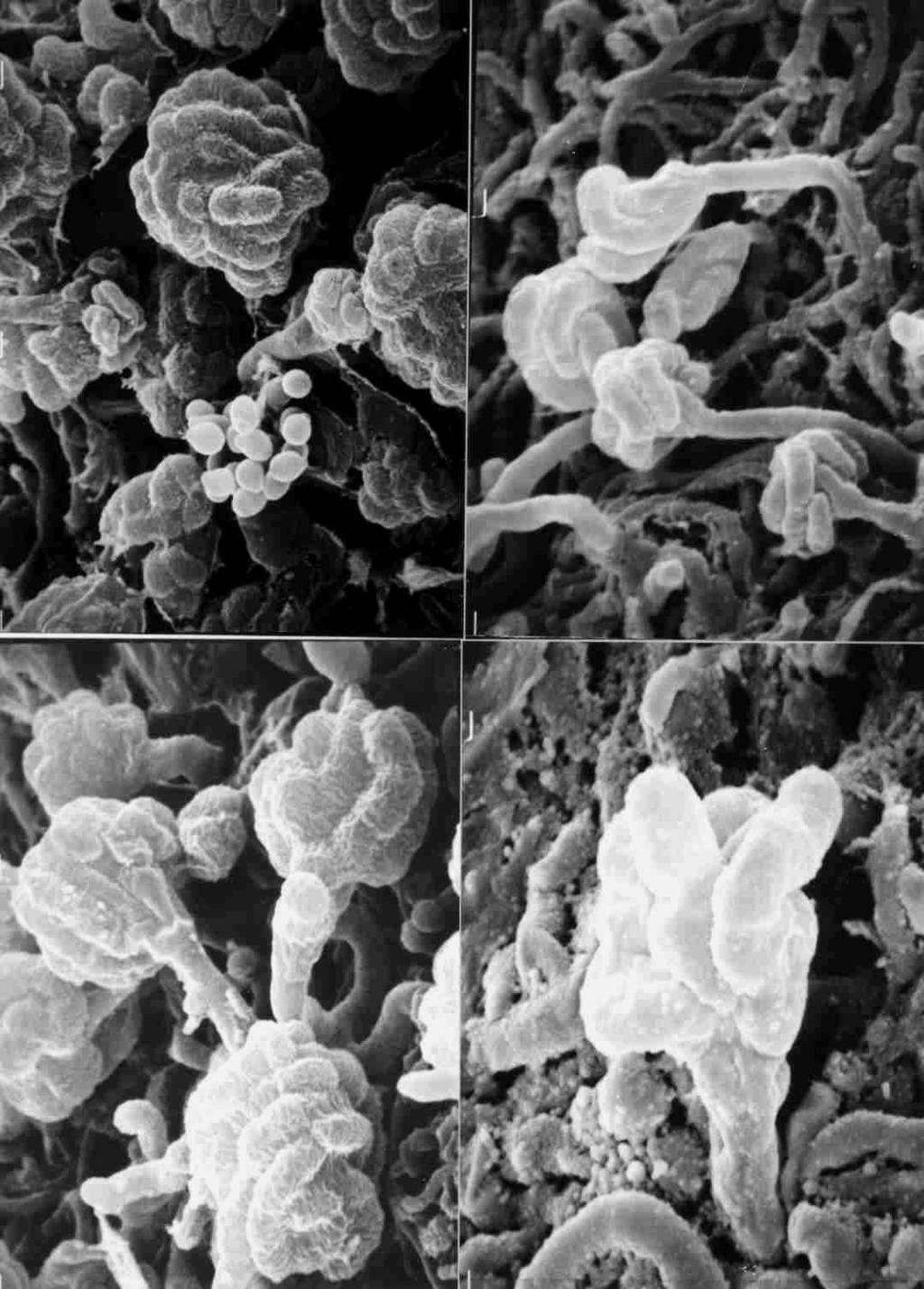 Sporangia of Actinoplanes species isolated from soil in Scanning