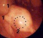 Die Normalgeburt Brunst Trächtigkeit Befruchtung Eizellentwicklung Ovulation Geburt Gelbkörper bzw.