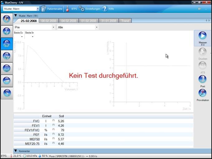 2.1 Das Fluss/Volumen Fenster Nach Anwahl der Schaltfläche F/V im Auswahlbereich links,