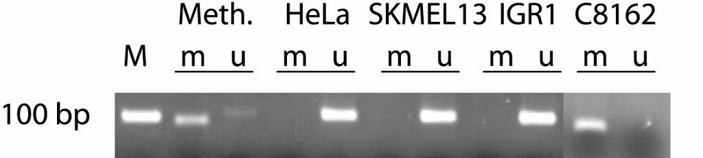 3 Ergebnisse 48 Zelllinien wurde zunächst der Promotor von RASSF1A-Gen hinsichtlich der Methylierung untersucht. In den Zelllinien HF53 (siehe Abbildung 3.