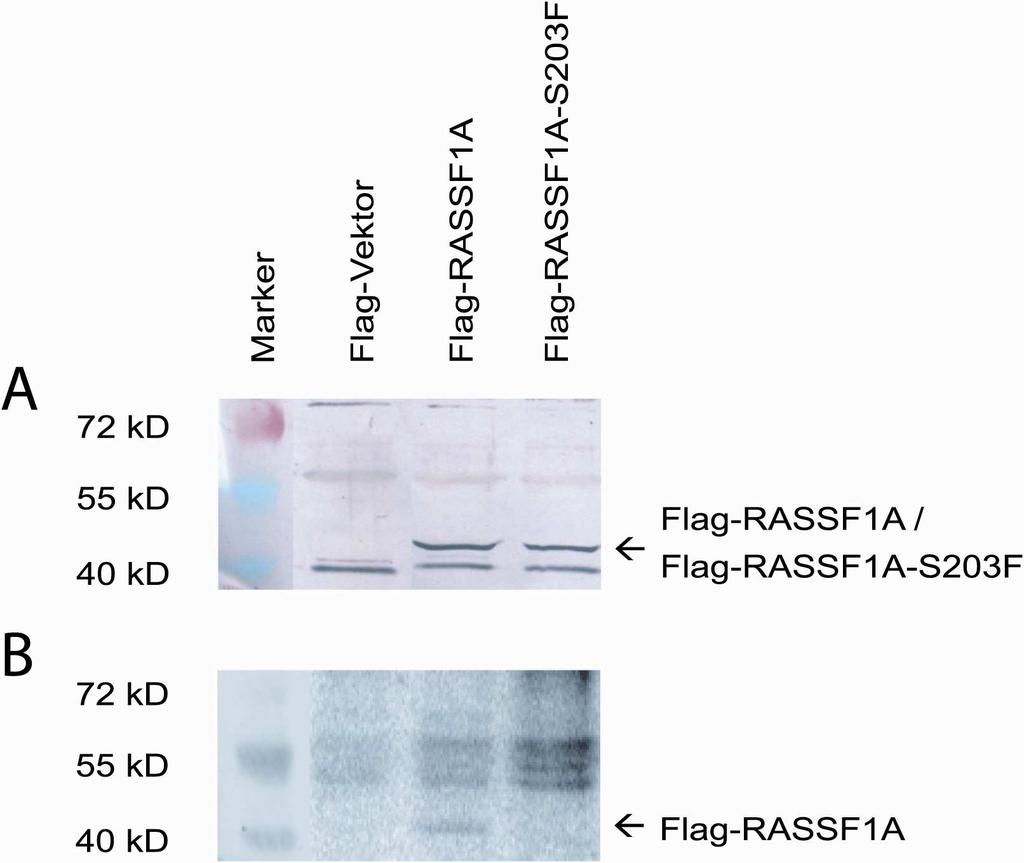 3 Ergebnisse 62 3.4.2 Phosphorylierung von Flag-RASSF1A aus humanen Zellen Um ausschließen zu können, dass die Phosphorylierung nur an rekombinantem Fusionsprotein aus E.