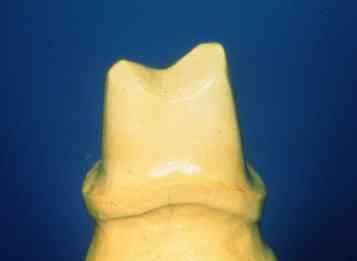 Gipstypen in der Zahnheilkunde V.