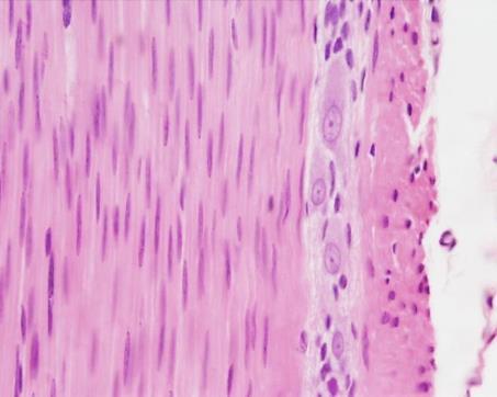 Glatte Muskulatur Blue Histology Röhlich Gefäßwand Gebärmutter Darmwand funktionelle Einheit: