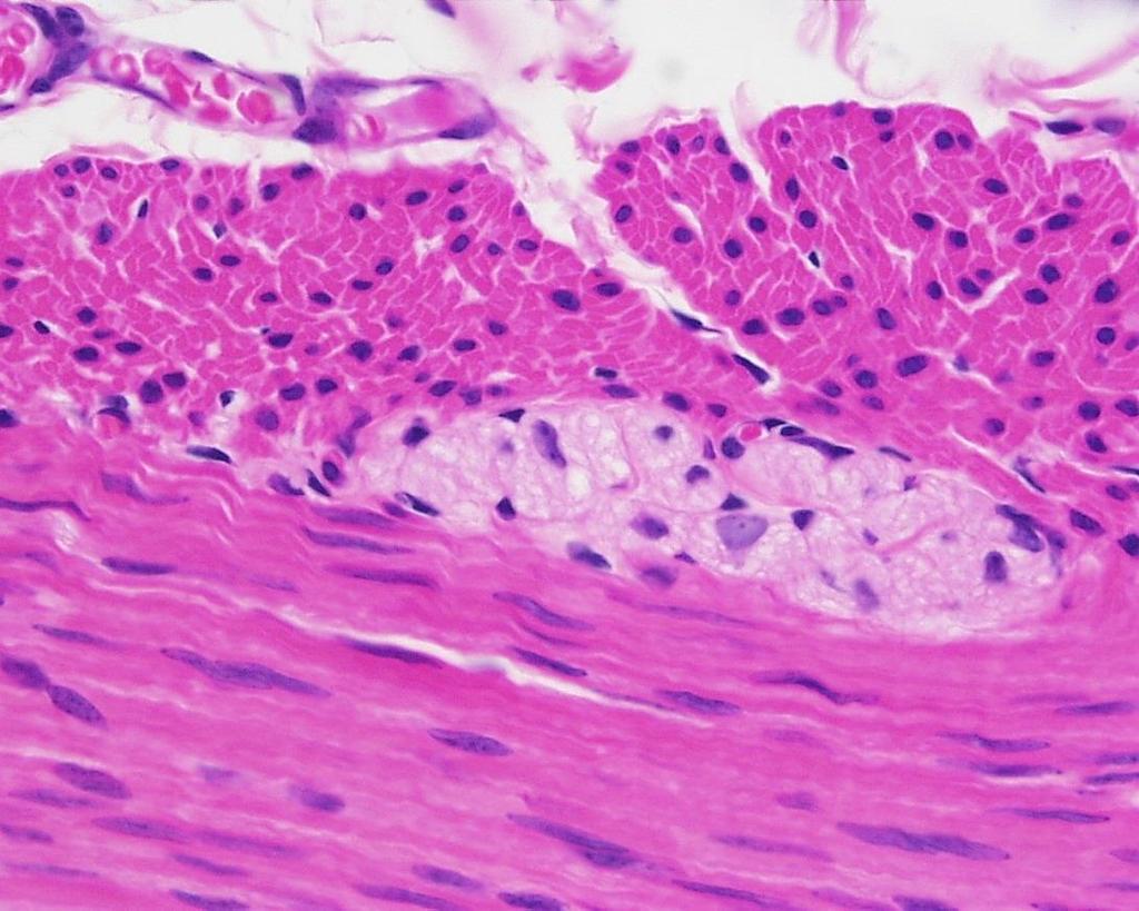 Innervation der glatten Muskulatur Blue Histology ein Ganglion intramurale im Dickdarm Plexus myentericus