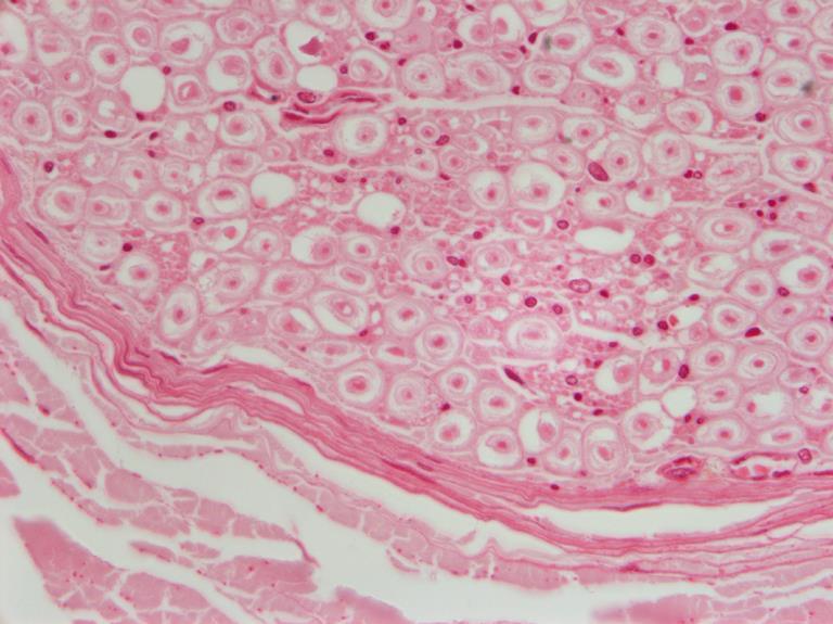 Querschnitt eines peripheren Nerves Stelle der ehemaligen Myelinscheide Schwannsche Zelle (Zellkern)
