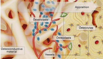 Eigenschaften von Knochenersatzmaterialien Osteokonduktion: passive Stimulation der