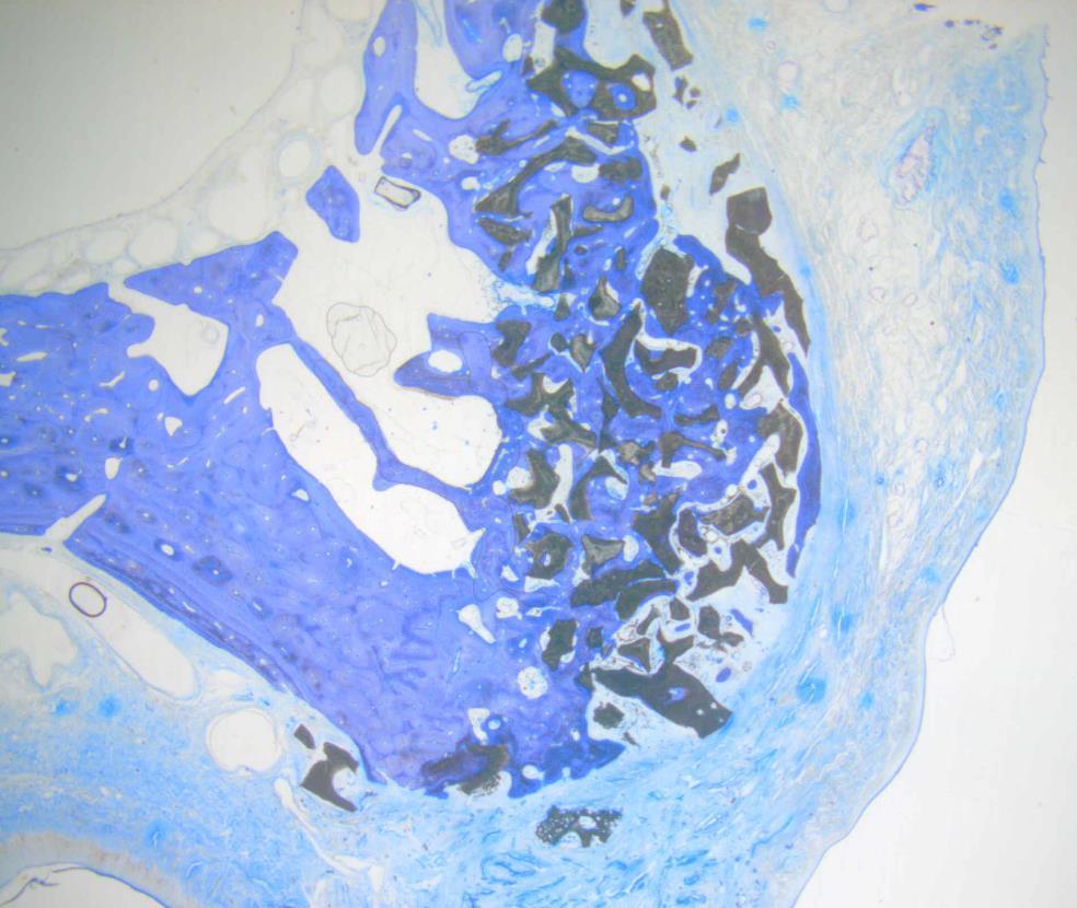 Exzelente Biokompatibilität und Gewebintegration Histologie nach subkutaner Implantation: Hundemodell Jason membrane + cerabone BioGide