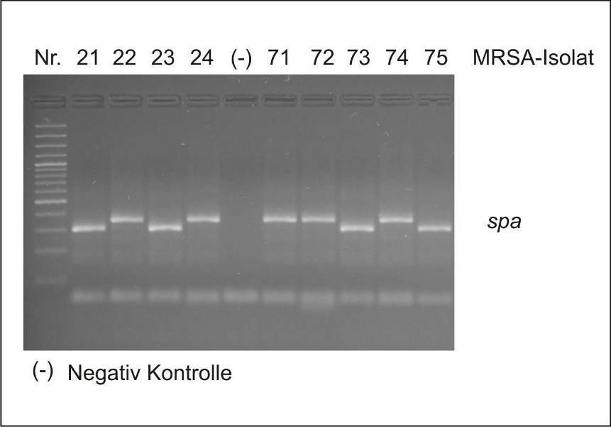 MRSA - Molekulartypisierung SCCmec typing: Multiplex PCR ref. Zhang et al.