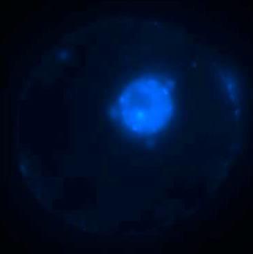 Epifluoreszenz-Mikroskop betrachtet. Fluoreszenzbilder dieser Protoplasten sind in Abbildung 4.19 gezeigt.