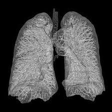 Vergleich Basics Lunge - Oxygenator Oberfläche 70