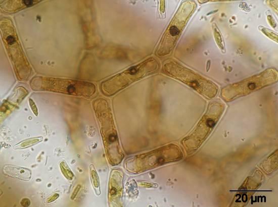 Hydrodictyon reticulatum, die auch den deutschen Namen Wassernetz trägt, ist eine makroskopisch auffällige, meist aufschwimmende Grünalgenart, die vor allem in stehenden Gewässern vorkommt.