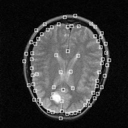 Ergebnisse (cont d) MRI Tomo1451.