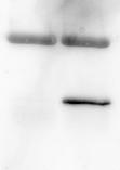 Aus Abbildung 3-14 ist außerdem erkennbar, dass SOCS1-mRNA in unstimulierten Zellen nicht oder nur geringfügig nachweisbar war.