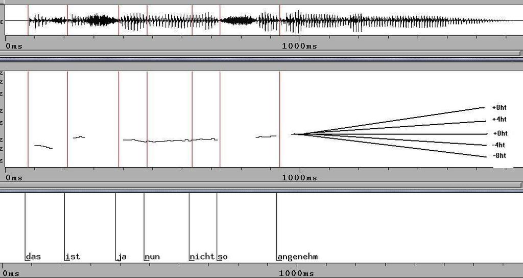 Weiterführende Untersuchungen zu prosodischen Grenzen 285 Abbildung 9: Resynthetisierte melodische Muster.