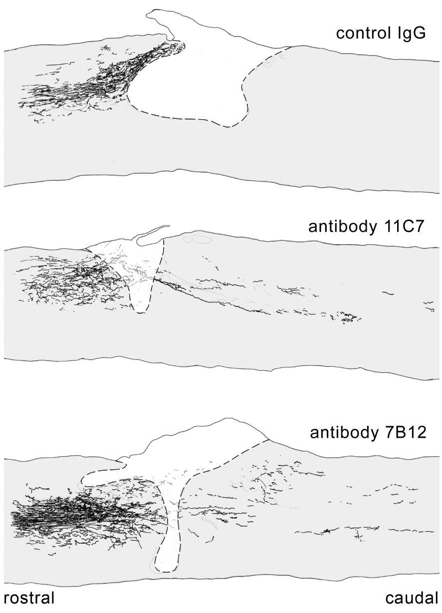 Antibodies against Nogo-A enhance axon