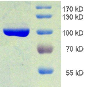 SPEZIELLER TEIL 39 3.5.1.3 Protein-Reinigung Die Proteinreinigung der mittels Ultraschall aufgeschlossenen Zellen, wurde über Immobilisierte Metallionen Affinitätschromatographie (IMAC) durchgeführt.
