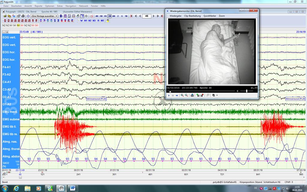 Kardiorespiratorische Polysomnographie EEG EOG EMG Atmung oronasal thorakal abdominal EKG