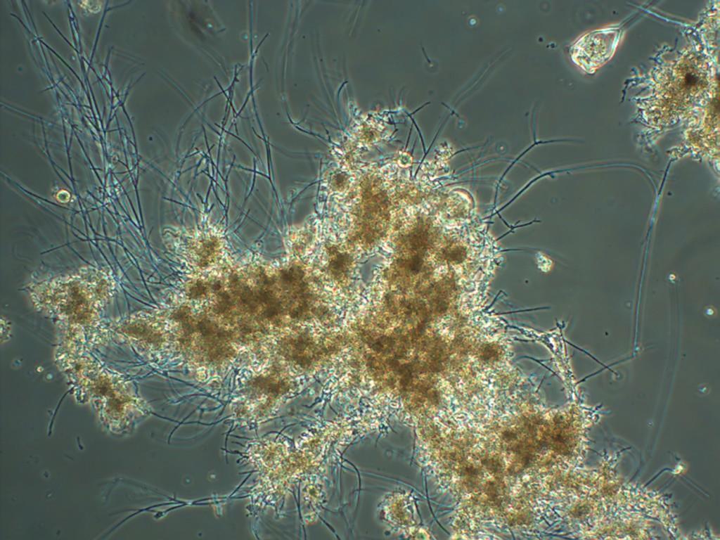 Vorfällung Beispiel einer Biologie mit Stossbelastung unter dem Mikroskop